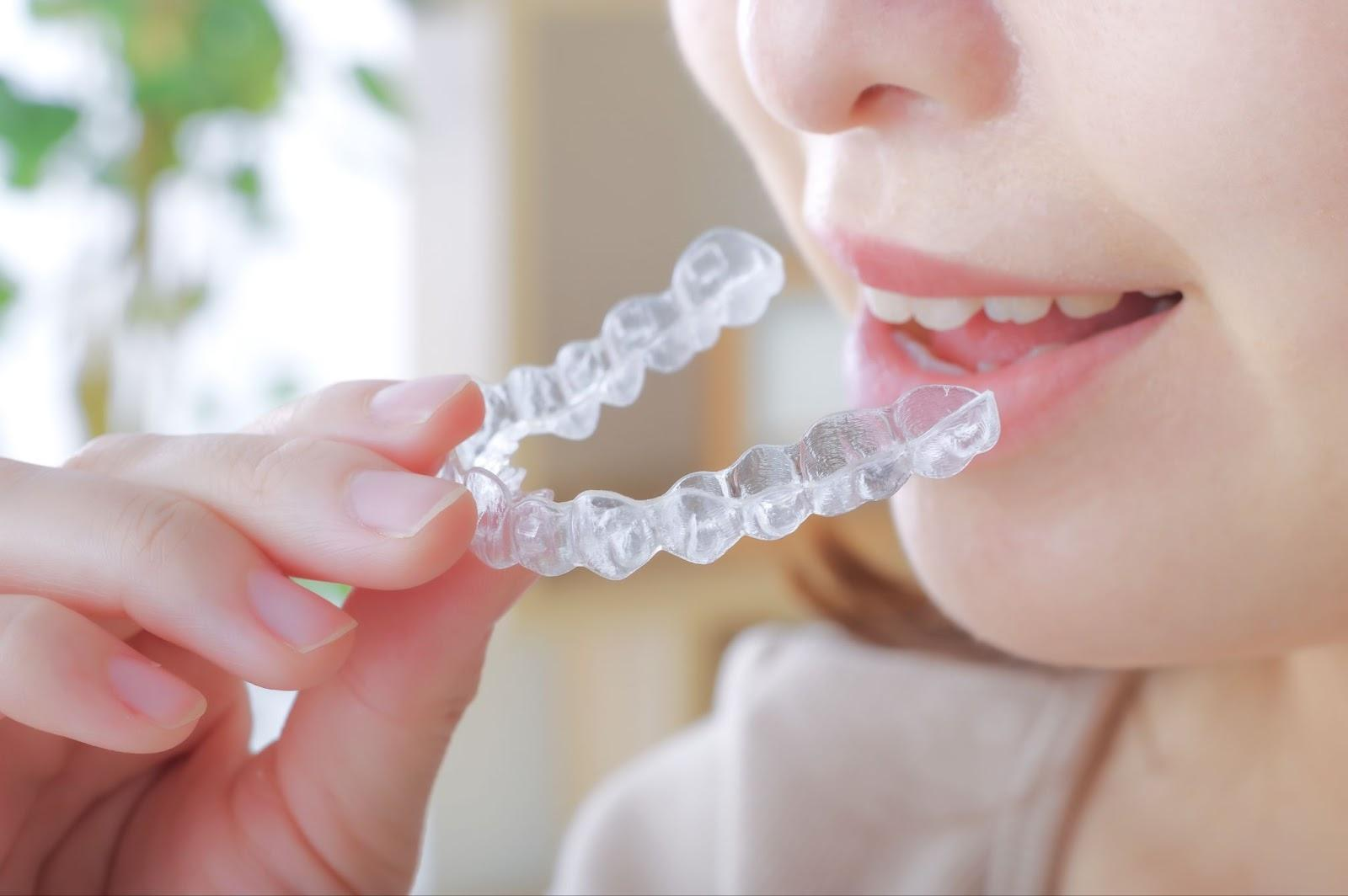 インビザラインの費用はいくら？相場や内訳、費用負担を抑えるポイントを解説