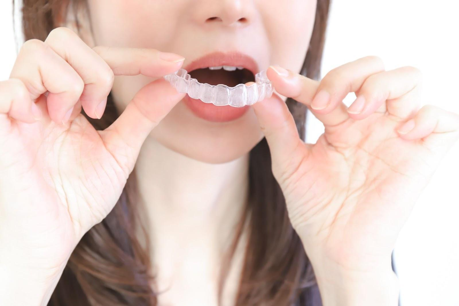 無理なくインビザラインの装着時間を守る方法