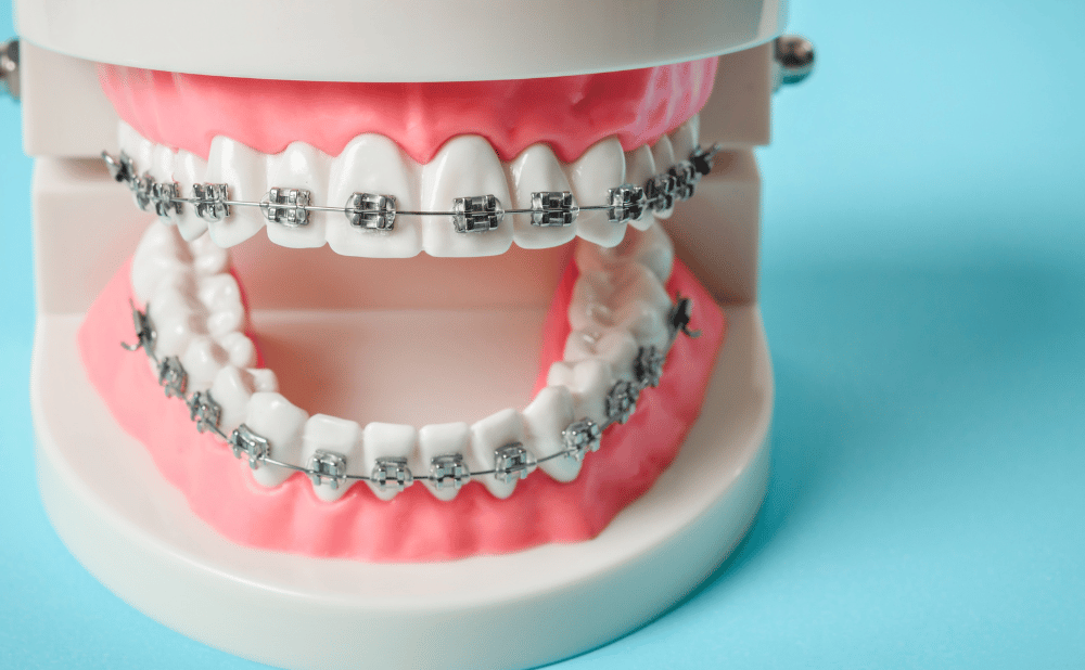 岩倉市で矯正歯科を受診するなら？安全に治療を開始するポイント