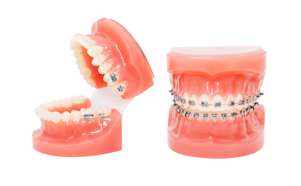 歯列矯正でなぜ顔の歪みを改善できるのか