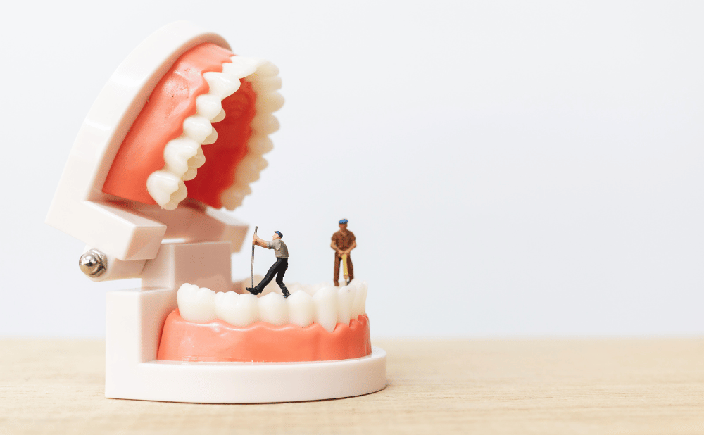 インプラント周囲炎の原因